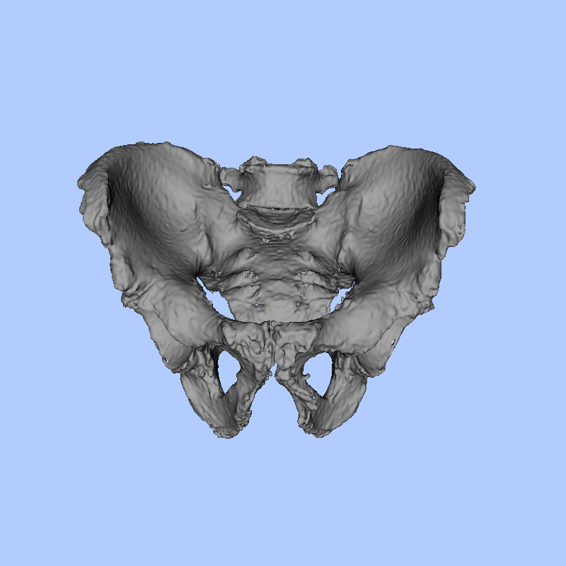 Example 2 Pelvis Rendering