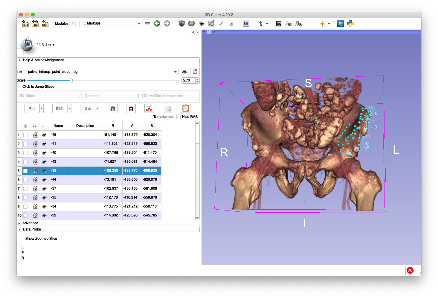 Example Pelvis Regi. Point Cloud