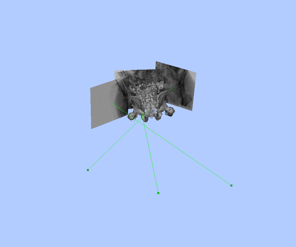 Example 1 Larger Orbital Rotation X-ray Scene 1